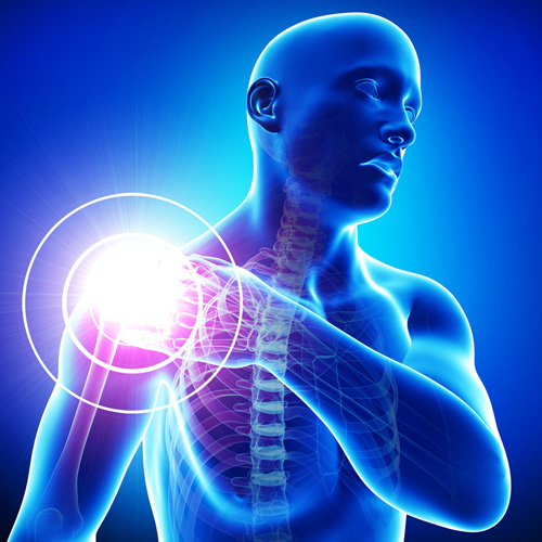 miért fáj a vállízület, mit kell tenni artrózis kezelési tünetek